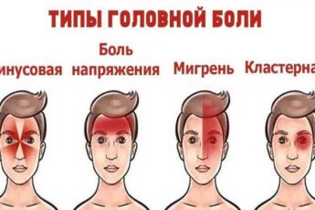 4 вида головной боли