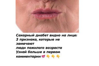 Прекратите кормить дuабет. Сахарный диабет видно на лице:17 признака, которые не замечают люди пожилого возраста